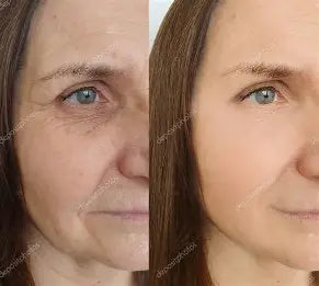 Andrea | 37 Años