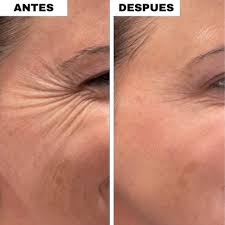 1+1 GRATIS | Elixir LuminaBelle- Juventud y Firmeza al instante