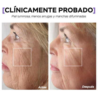 1+1 GRATIS | Elixir LuminaBelle- Juventud y Firmeza al instante